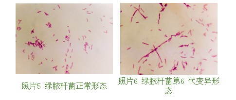 菲彩国际集团_第十节 烧伤湿性医疗手艺MEBO的抗菌作用实验研究（续）