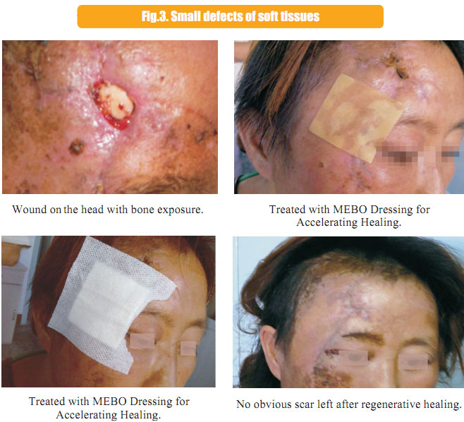 菲彩国际集团_1  Regenerative recovery of traumas