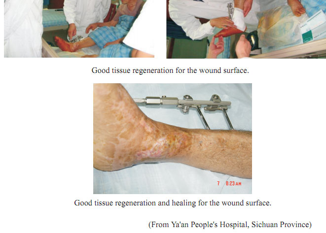 菲彩国际集团_1  Regenerative recovery of traumas