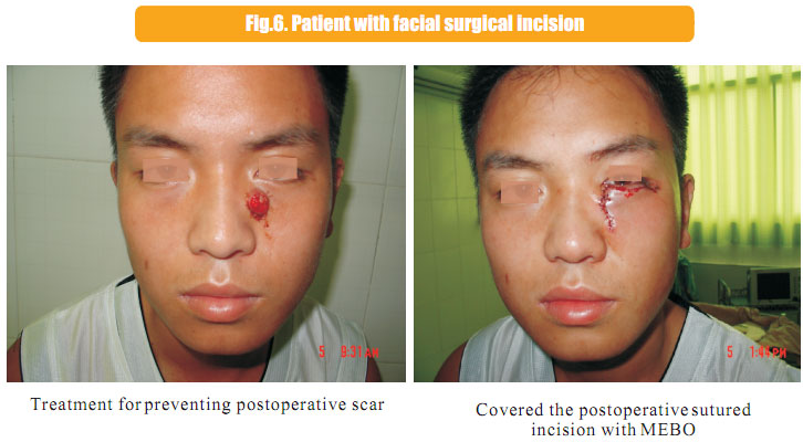 菲彩国际集团_1  Regenerative recovery of traumas