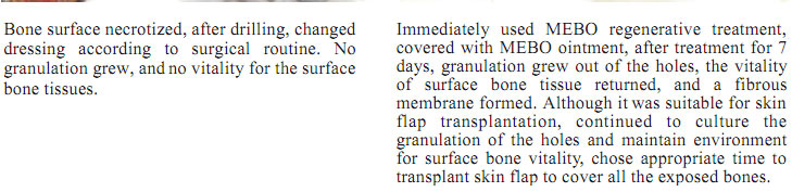 菲彩国际集团_1  Regenerative recovery of traumas