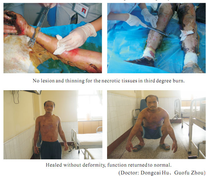 菲彩国际集团_1  Regenerative recovery of traumas