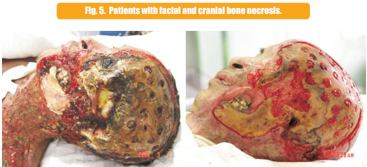菲彩国际集团_1  Regenerative recovery of traumas