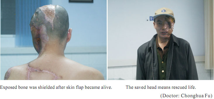 菲彩国际集团_1  Regenerative recovery of traumas
