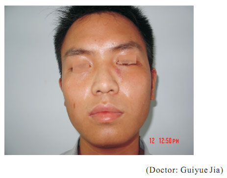 菲彩国际集团_1  Regenerative recovery of traumas