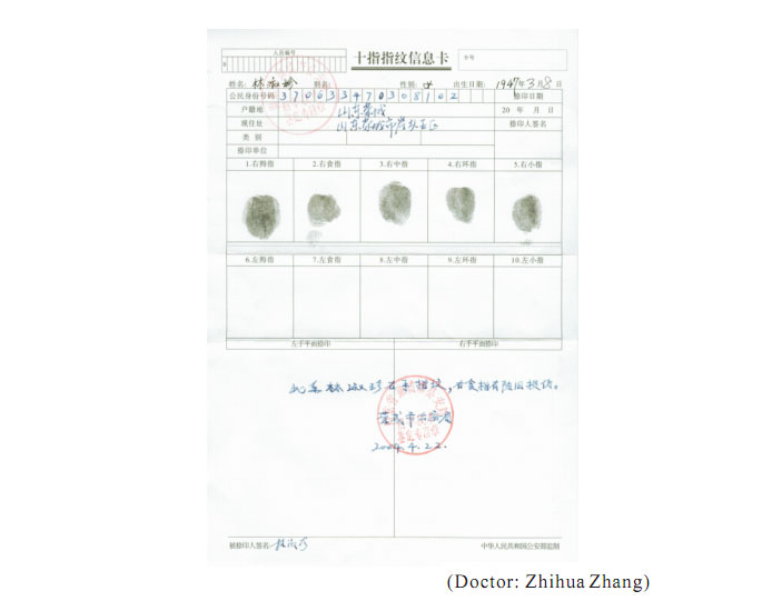 菲彩国际集团_2 Regenerative restoration ofr severed fingers