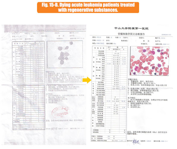 菲彩国际集团_7  In situ regenerative restoration of multiple organs