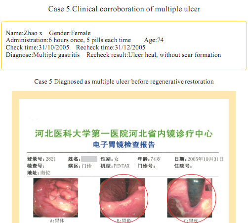 菲彩国际集团_Part Seven: Clinical Corroboration