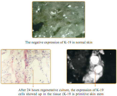 菲彩国际集团_Part One: In situ Skin Regenerative Restoration & Rejuvenati