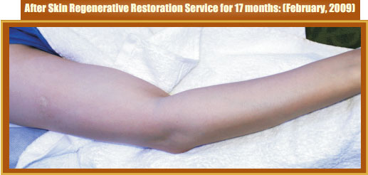 菲彩国际集团_Part Two: Examples of in situ Skin Regenerative Restoration