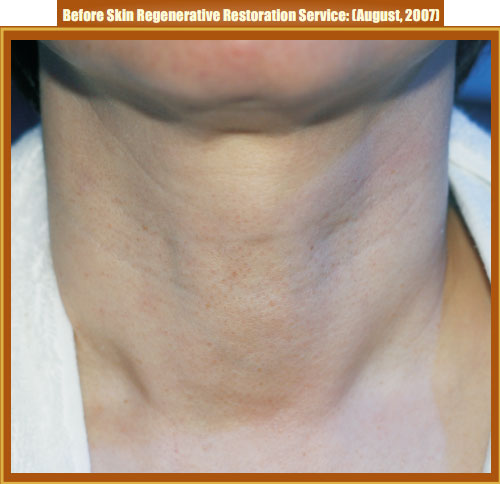 菲彩国际集团_Part Two: Examples of in situ Skin Regenerative Restoration