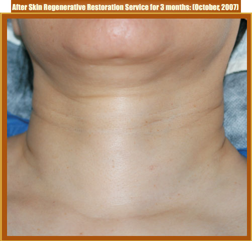 菲彩国际集团_Part Two: Examples of in situ Skin Regenerative Restoration