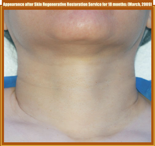 菲彩国际集团_Part Two: Examples of in situ Skin Regenerative Restoration