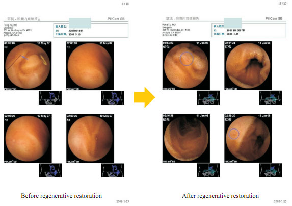 菲彩国际集团_How is an aged cell regenerated?