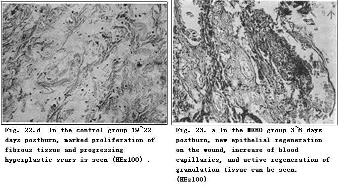 菲彩国际集团_Exploration of Pathological Changes and Mechanism of Experim