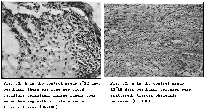 菲彩国际集团_Exploration of Pathological Changes and Mechanism of Experim