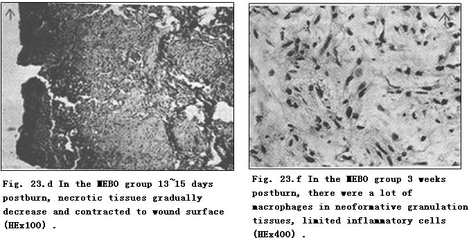 菲彩国际集团_Exploration of Pathological Changes and Mechanism of Experim