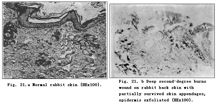 菲彩国际集团_Exploration of Pathological Changes and Mechanism of Experim