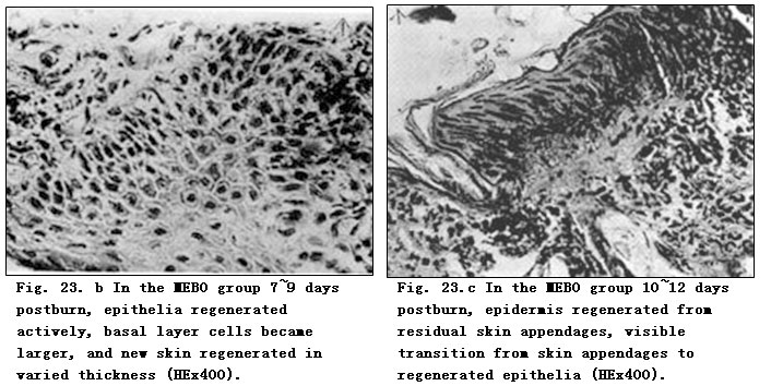 菲彩国际集团_Exploration of Pathological Changes and Mechanism of Experim