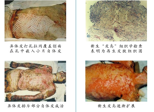 菲彩国际集团_四、两种疗法疗效比照举例（图示）